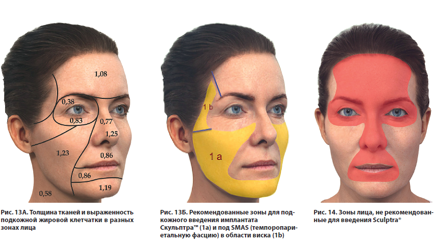 В зона на лице где. Периорбитальная зона глаз. Периорбитальные зоны лица. Орбитальная область лица. Параорбитальные области лица.