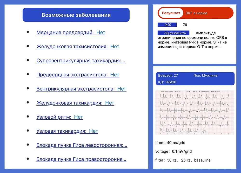 servis-rasshifrovki-ekg-health-watch-pro-5-chornyy servis-rasshifrovki-ekg-health-watch-pro-5-chornyy