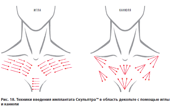 Точки профайло схема