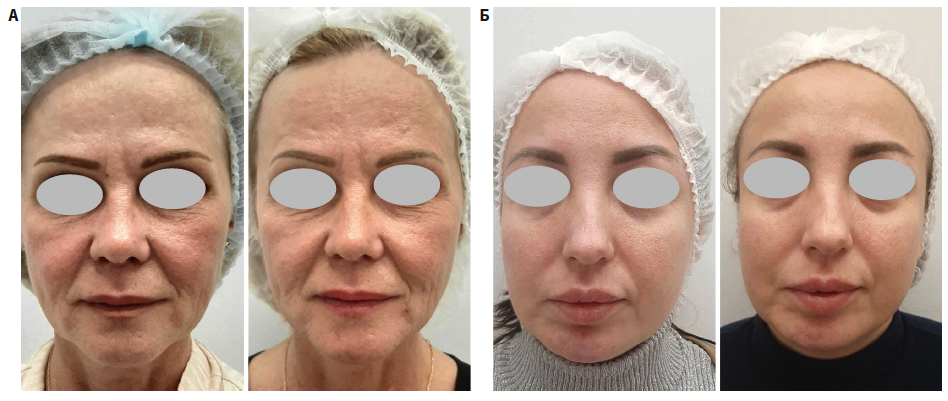 Юсова (Сигма Лаб) КМ 4-2025_Рис 5.png