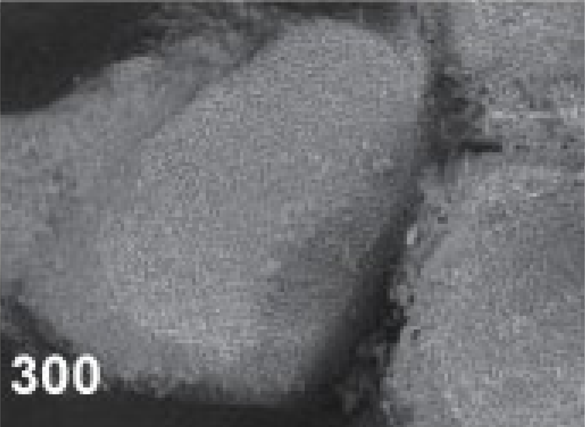SorBone_Syringe_по_электронным_микроскопом_300_1751532480549-1751532486303.png