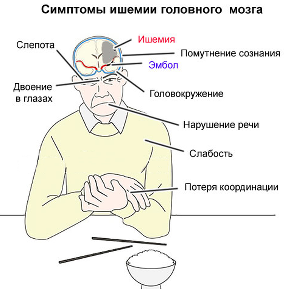 Хроническая ишемия головного мозга карта вызова скорой