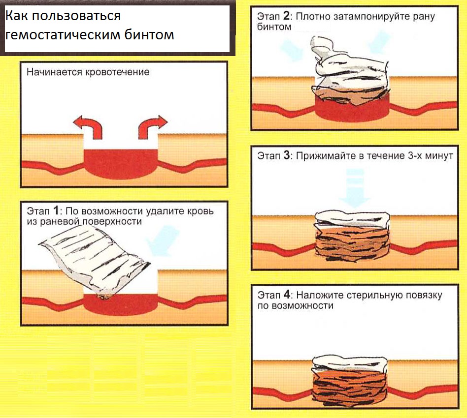 Как пользоваться гемостатическим бинтом Гепоглос