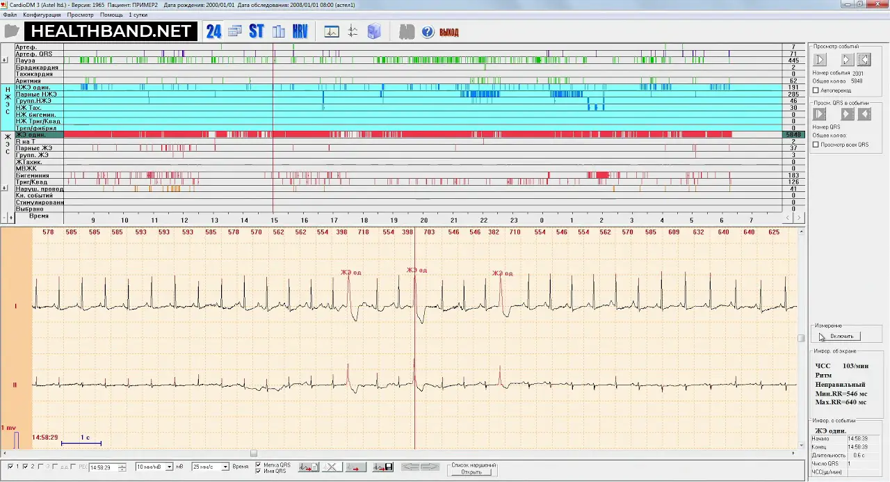 Просмотр данных холтер‑мониторинга на экране