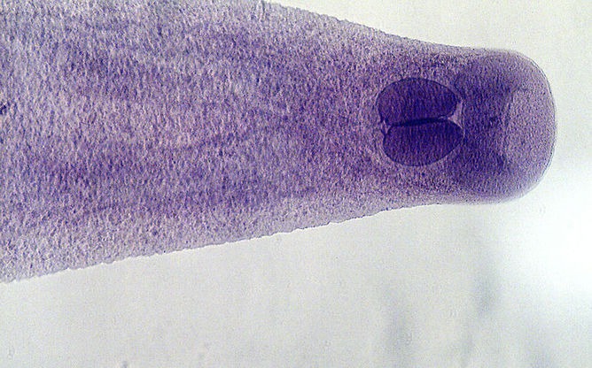 Opisthorchiinae.jpg