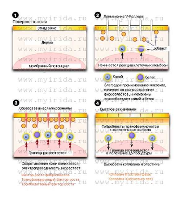 принцип действия мезороллера для глаз
