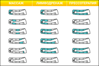 Надув камер в режимах массаж, лимфодренаж и прессотерапия