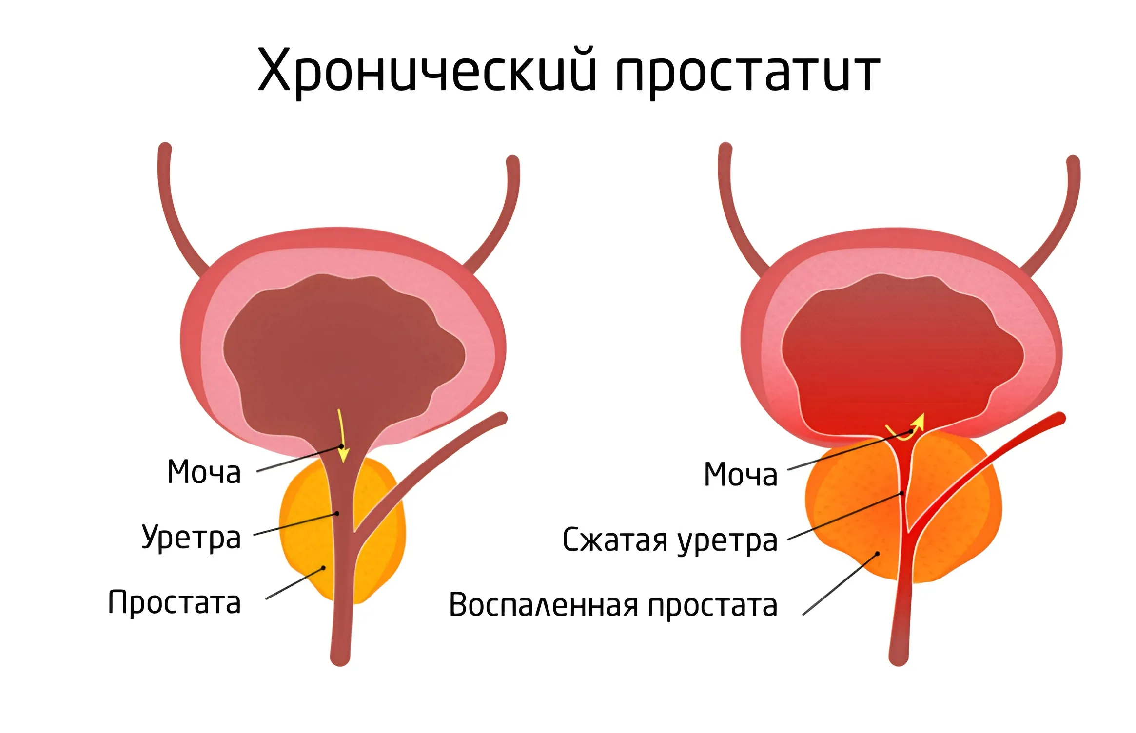 Простата выполняет функцию