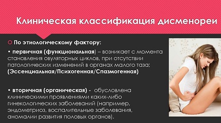 Классификация дисменореи