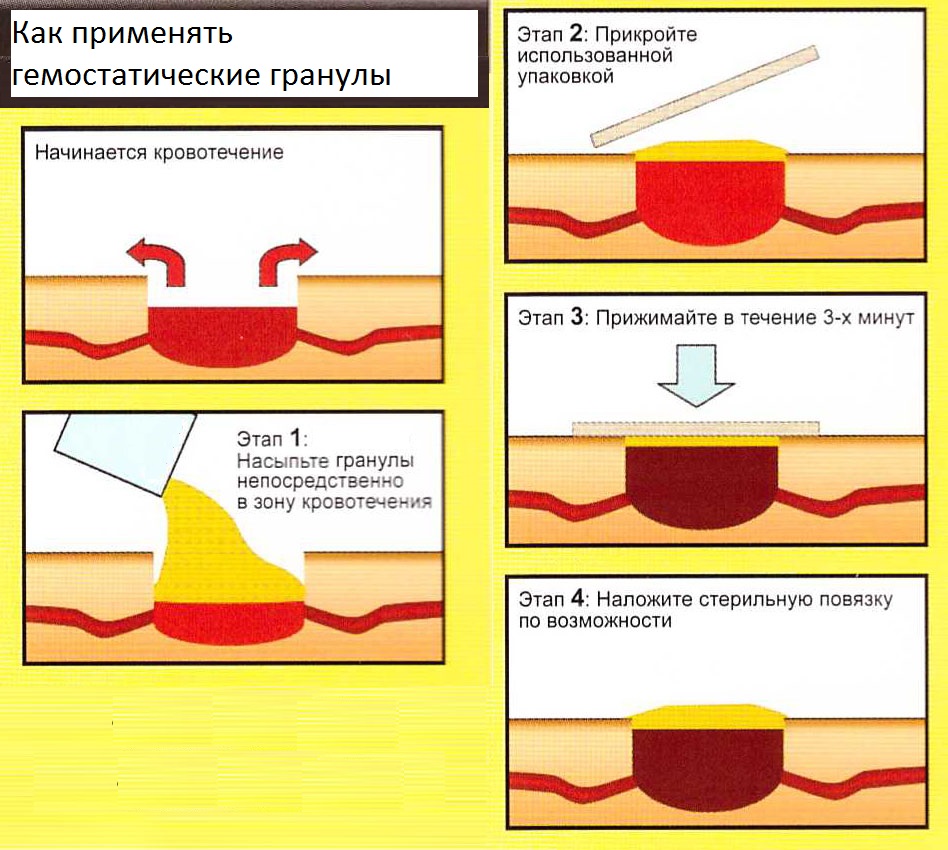 Как правильно использовать гемостатический порошок в гранулах