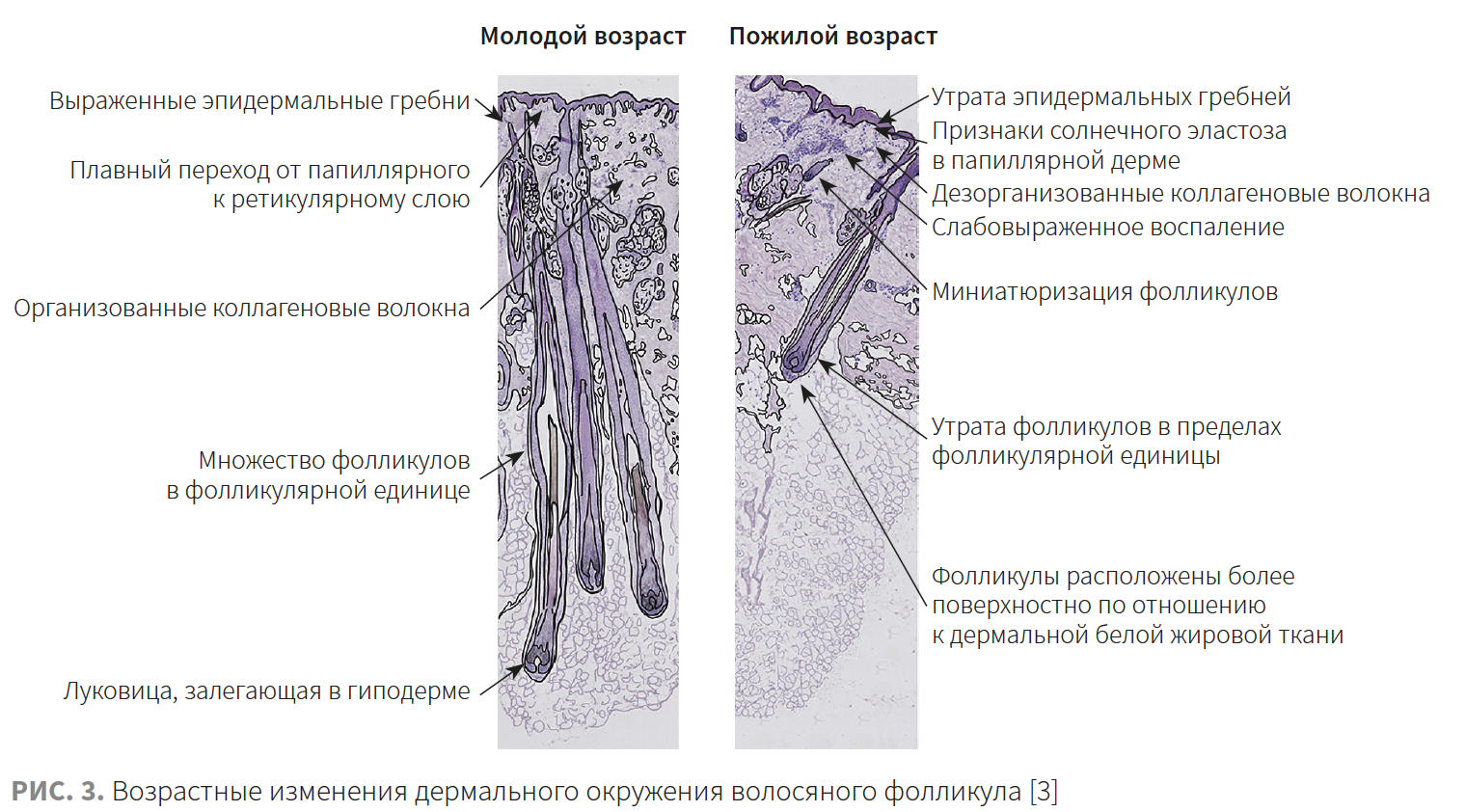 Ибатуллина (КМ 2-2023 (Ипсен) Рис 3.png