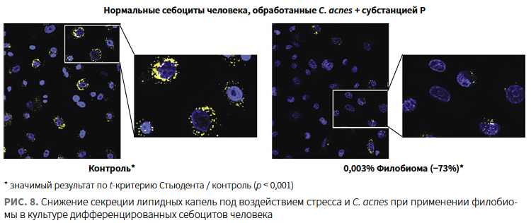 Назарова (ЛРП) КМ 1-2024_Рис 8.png