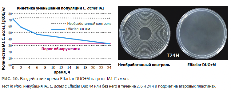 Назарова (ЛРП) КМ 1-2024_Рис 10.png