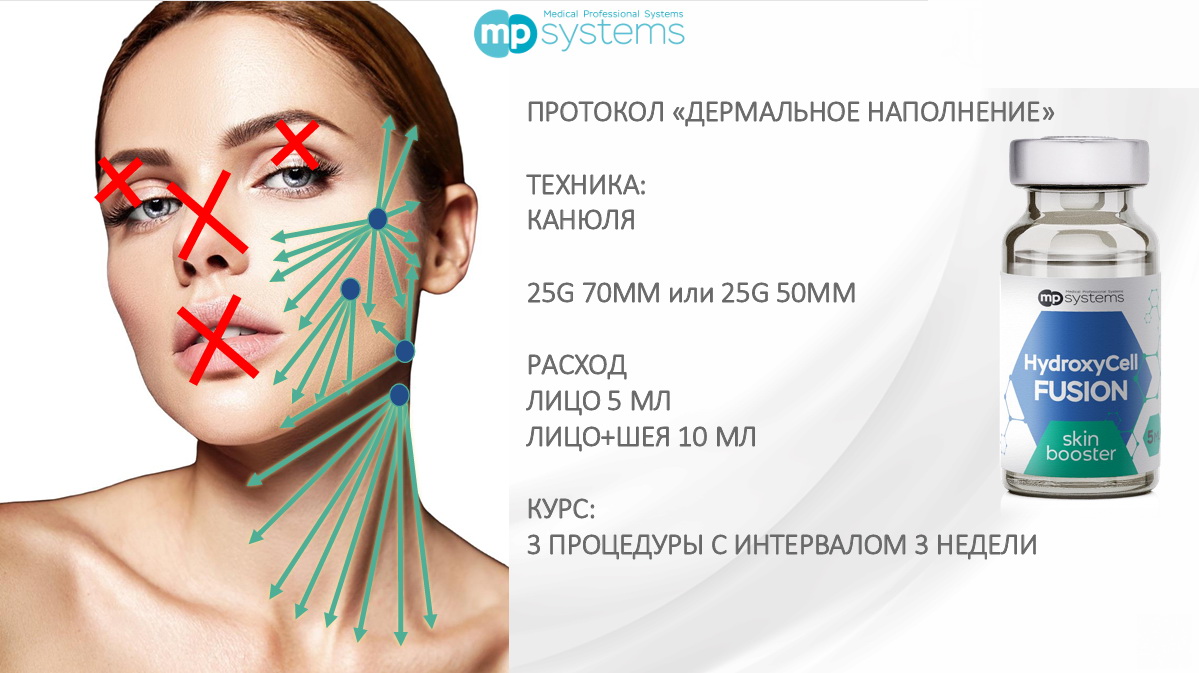 HydroxyCell Fusion MP Systems_Протокол_1.jpg
