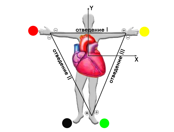 EKG-otvedeniya