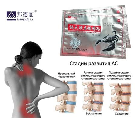 Обезбаливающий Пластырь при болях в мышцах и суставах Скорпион, разогревающий