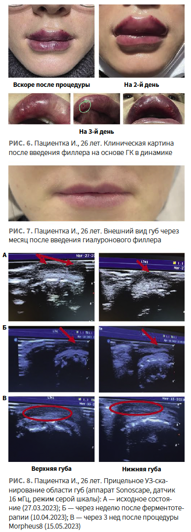 Лысикова (КИТ МЕД) КМ 1-2024_Рис 6-7-8.png