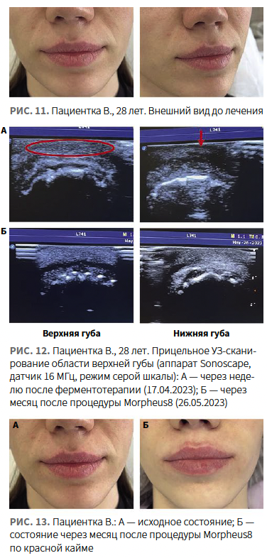 Лысикова (КИТ МЕД) КМ 1-2024_Рис 11-12-13.png