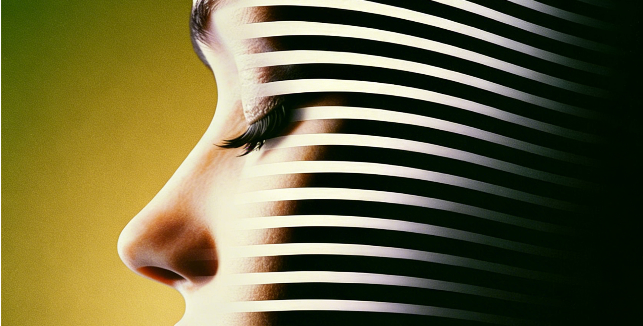 US Parallel for Acne scars_1000x500.jpg