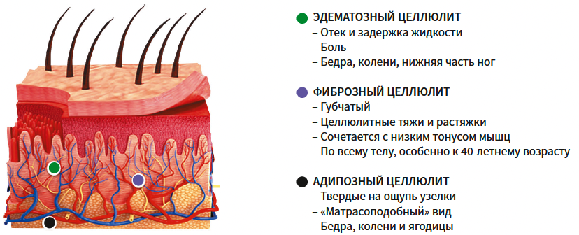 Токмакова (ЭлмТри) КМ 1-2025_Рис 2.png