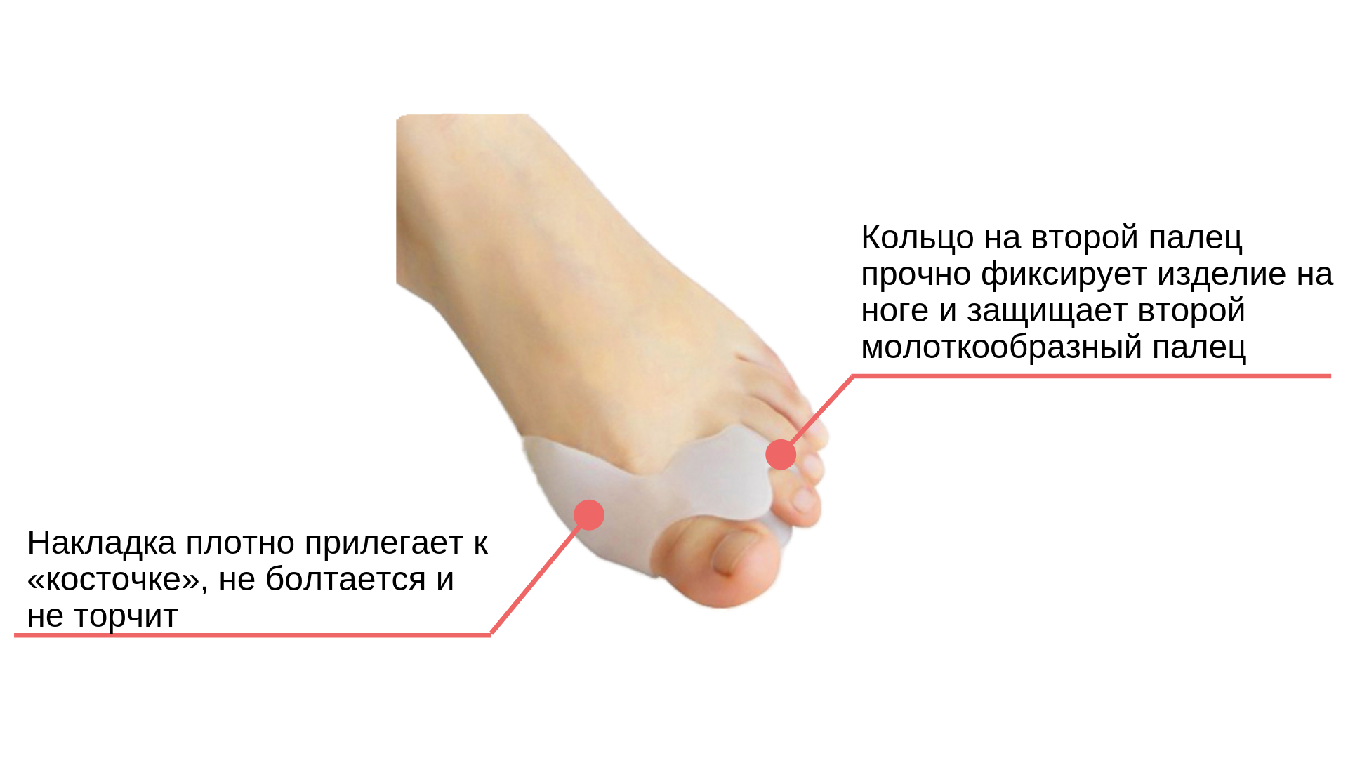 Ортопедические стельки от косточки на большом пальце ноги