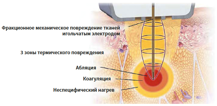 Сазонова КМ 3-2025_Рис 1.png