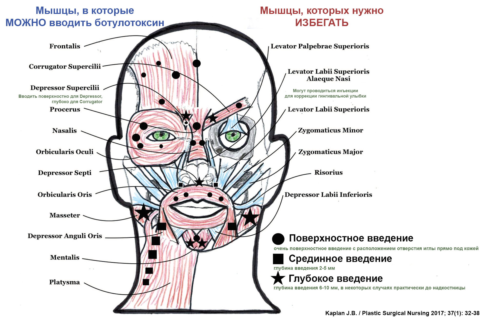 Схема введения ботулотоксина в лицо