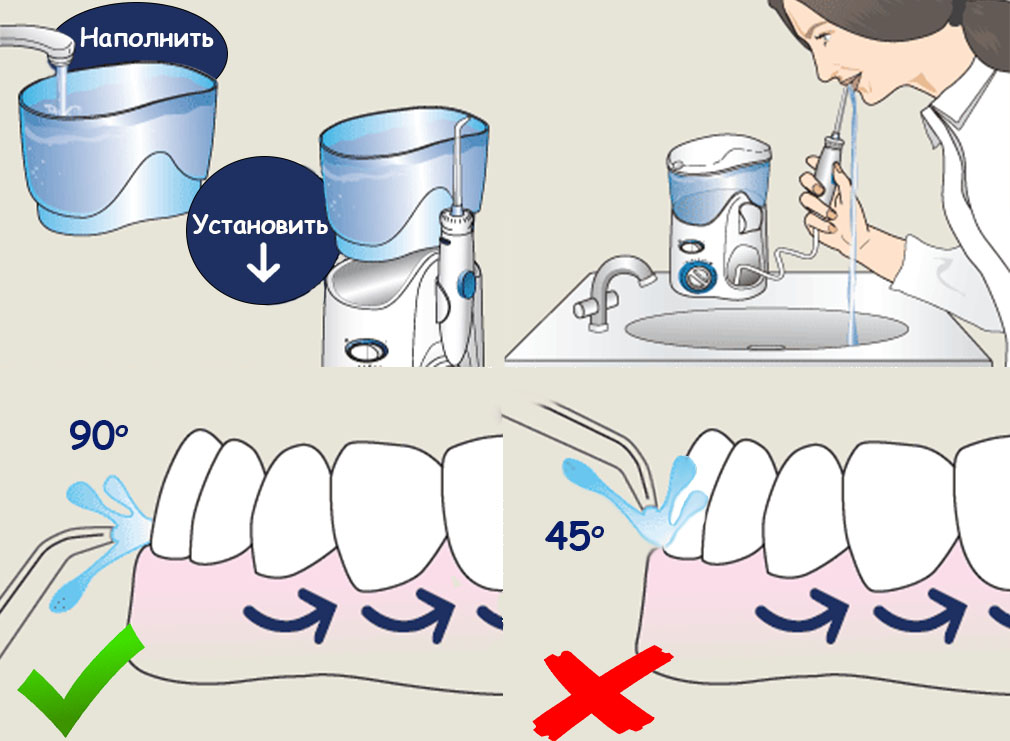 Ирригатор - главный помощник в чистке зубов