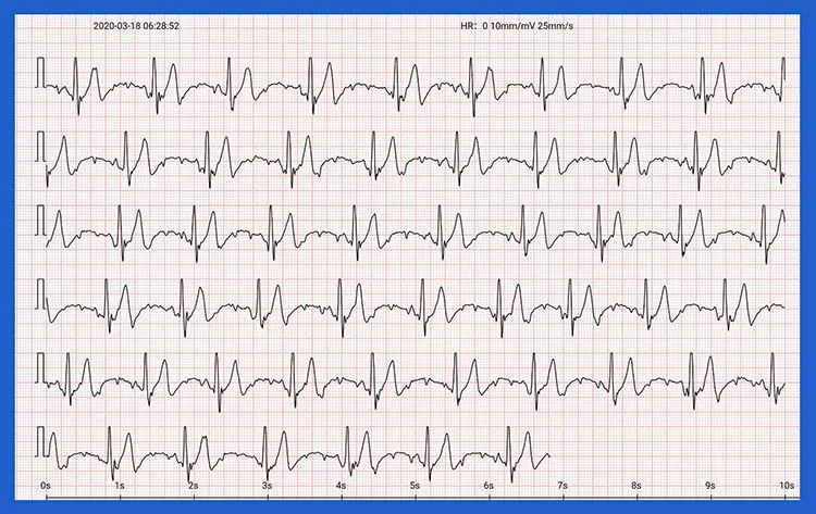 EKG-health-watch-pro-80-chornyy