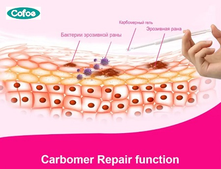 Гинекологический гель Cofoe CARBOMER, противовоспалительный гель