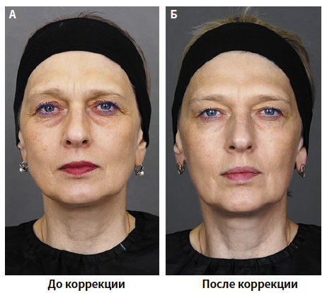 Бычкова (КИТ МЕД) 1-2025_Рис 1.png