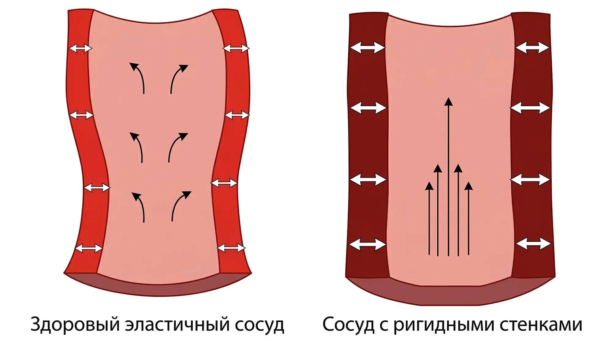 sosudy