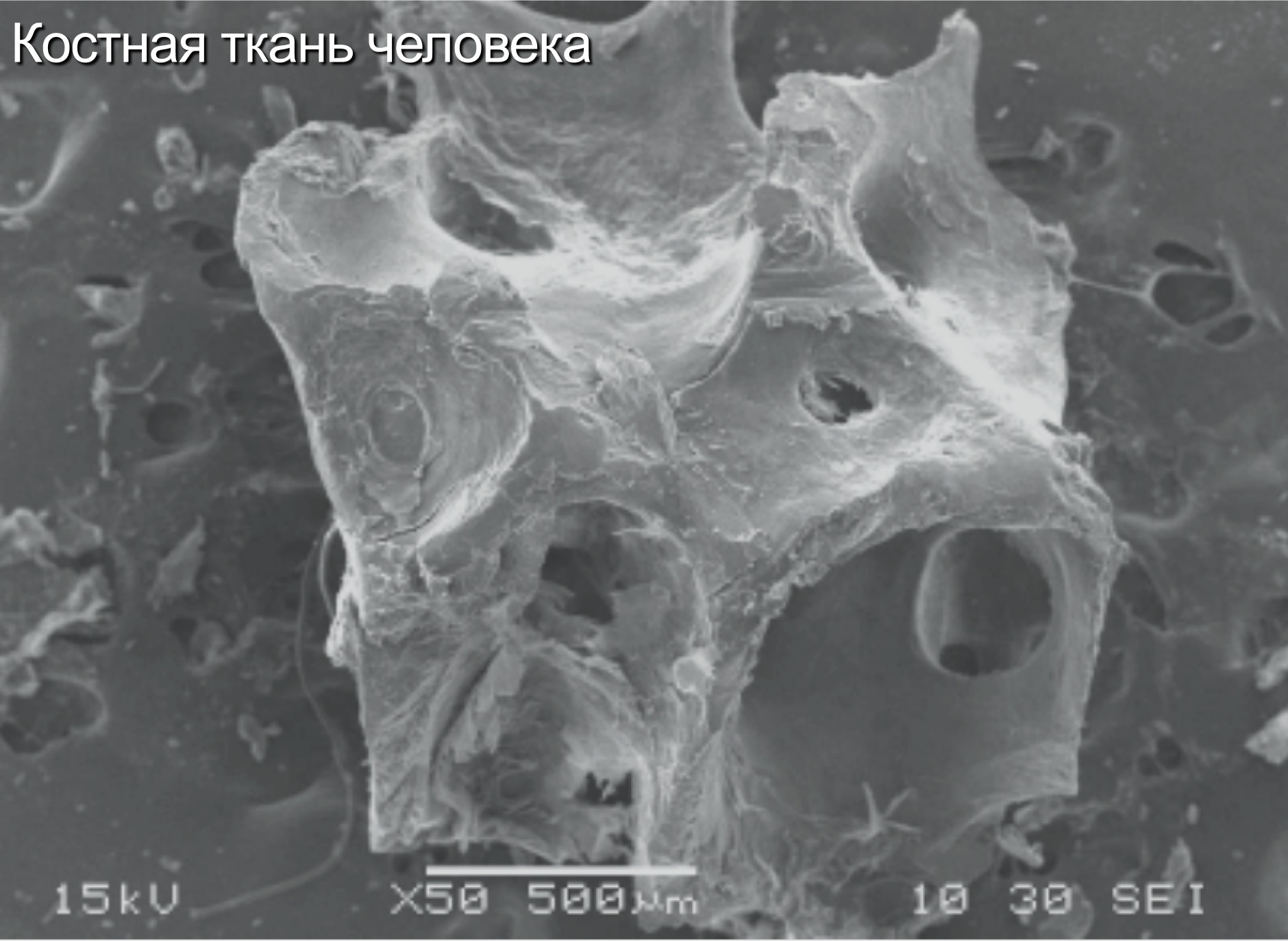 Костная ткань человека.jpg