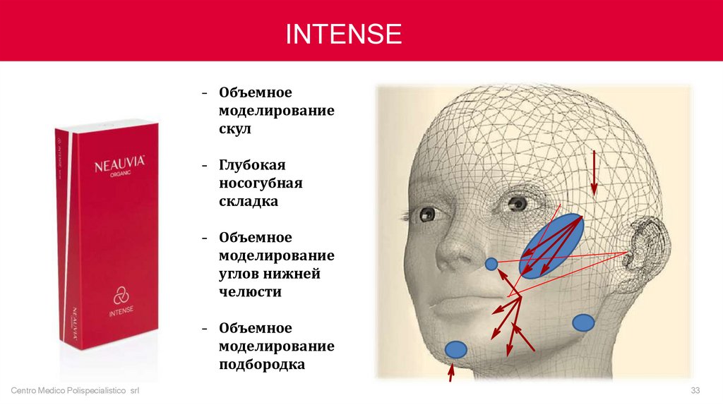 Neauvia Intense