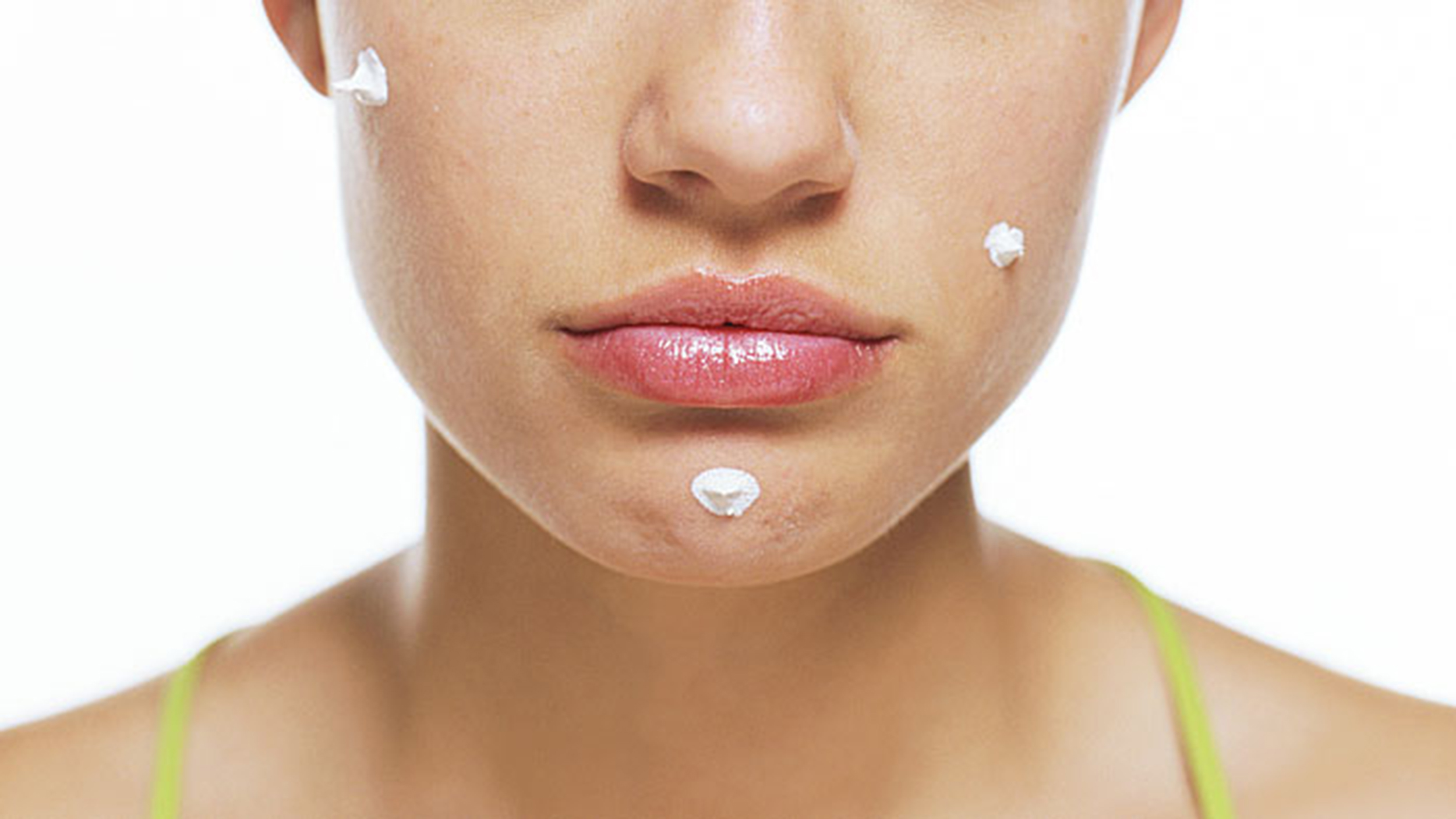 adult-acne-cures-stock-today-160212-tease_7997ee0de96317bd29183ae2f62c9ff8.jpg