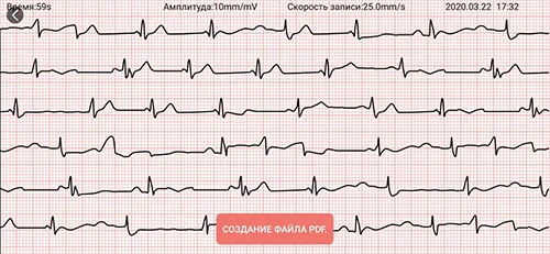 1s-black-HB10