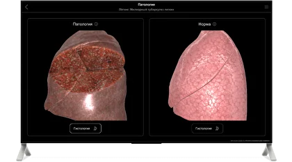 features-pathology_2.png.webp