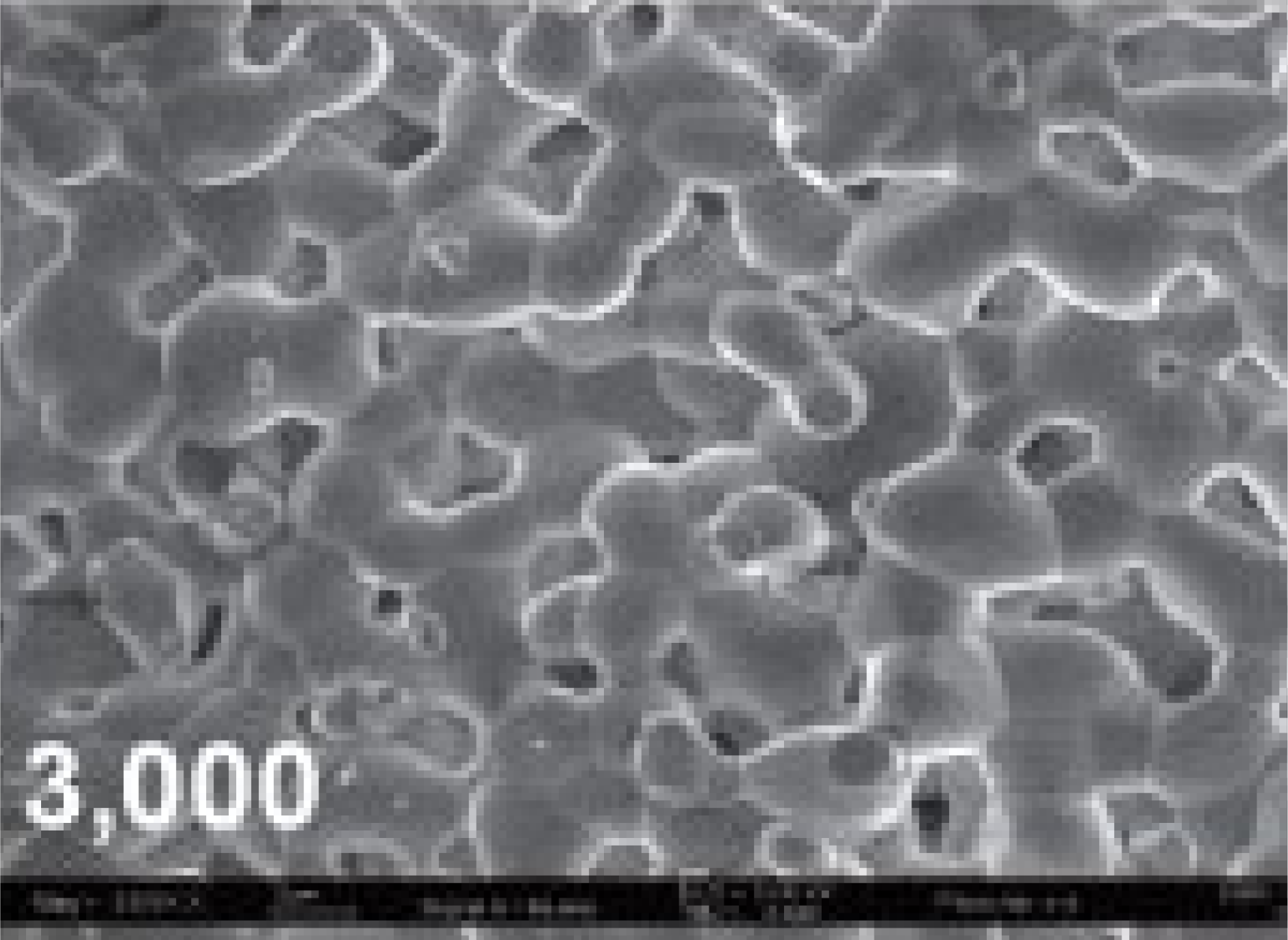 SorBone_Syringe_по_электронным_микроскопом_3000_1751532514501-1751532519427.png