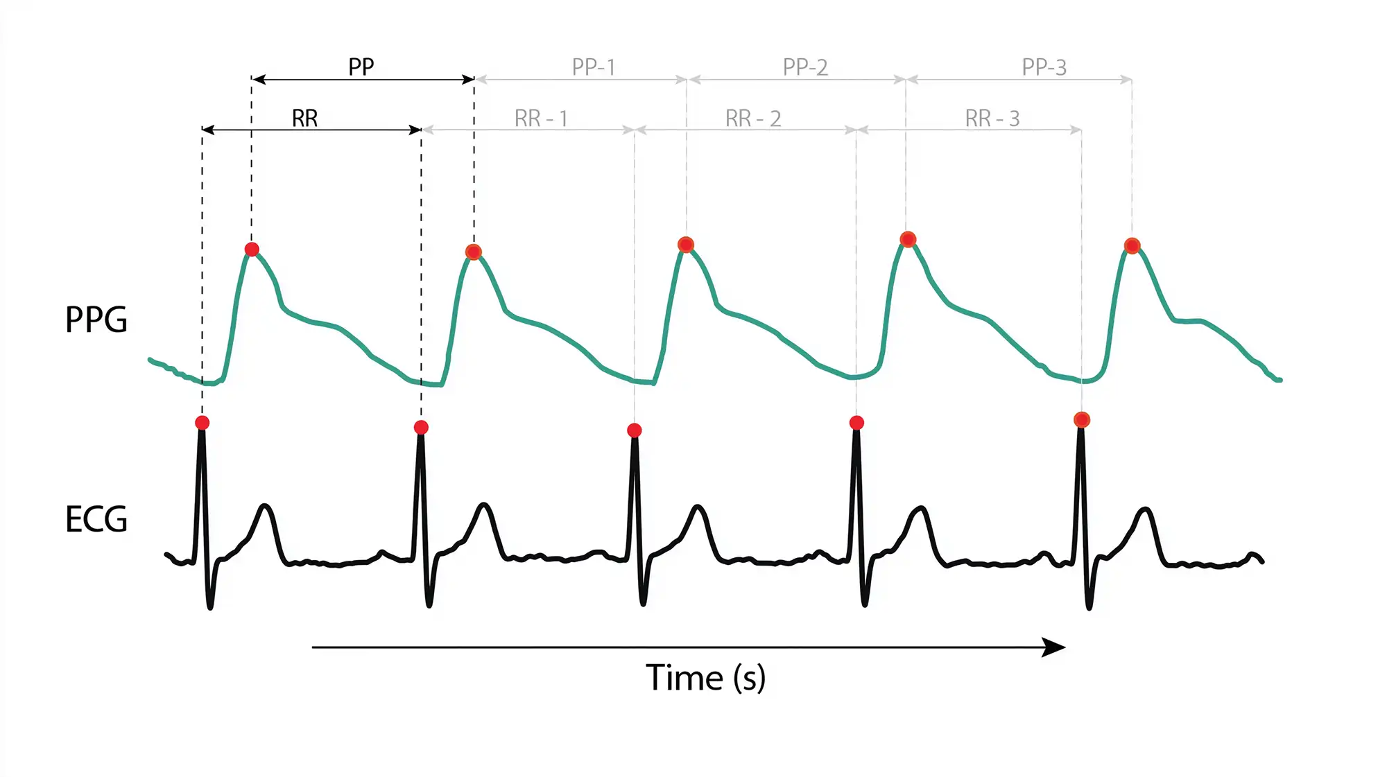 PPG-ECG