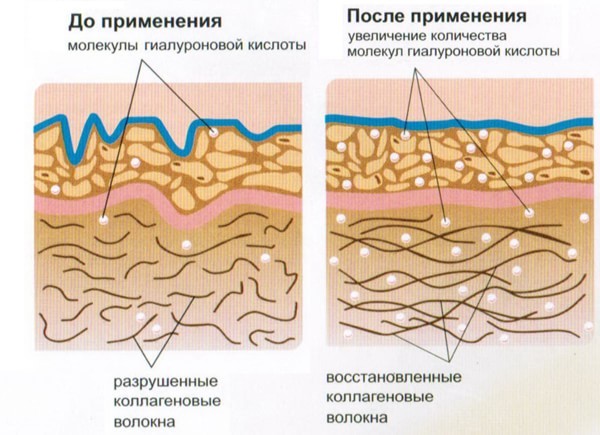 Что такое коллаген и зачем он нужен нашей коже?