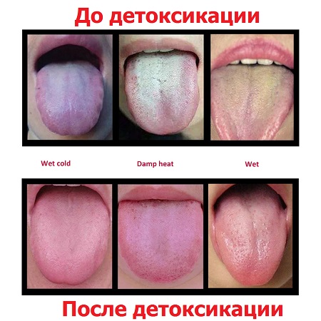 Детокс пластырь на стопы ног_результаты применения