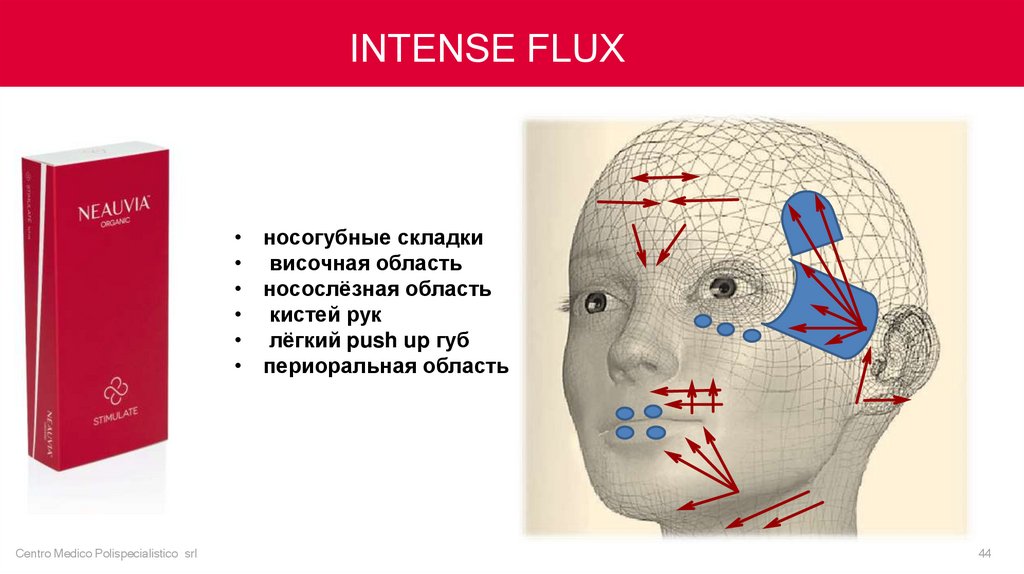 Neauvia Intense Flux