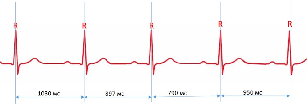 Вариабельность сердечного ритма