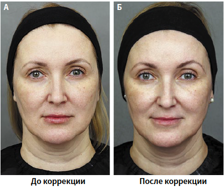 Бычкова (КИТ МЕД) 1-2025_Рис 9.png