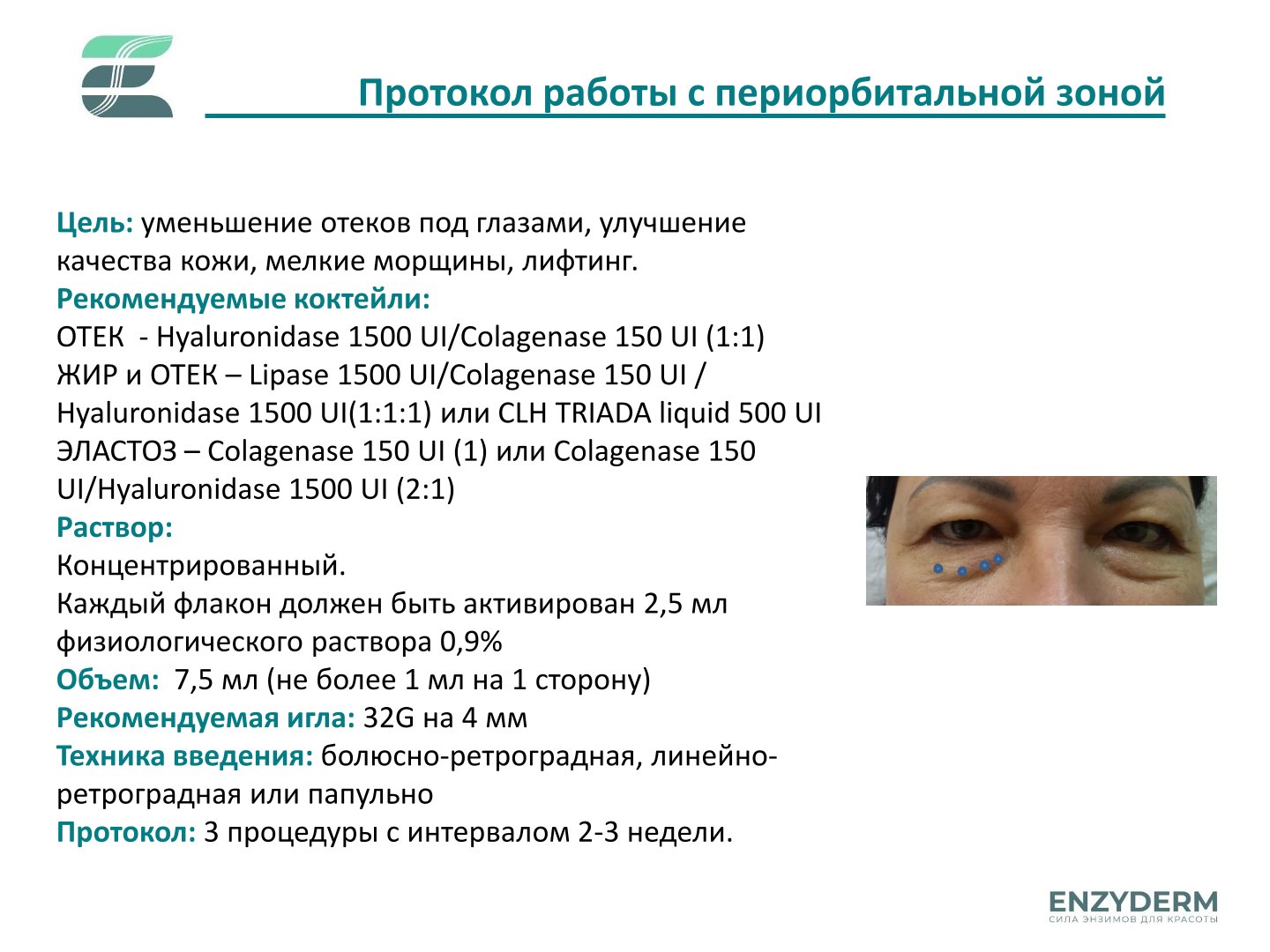 Hyaluronidase 1500 UI Enzyderm