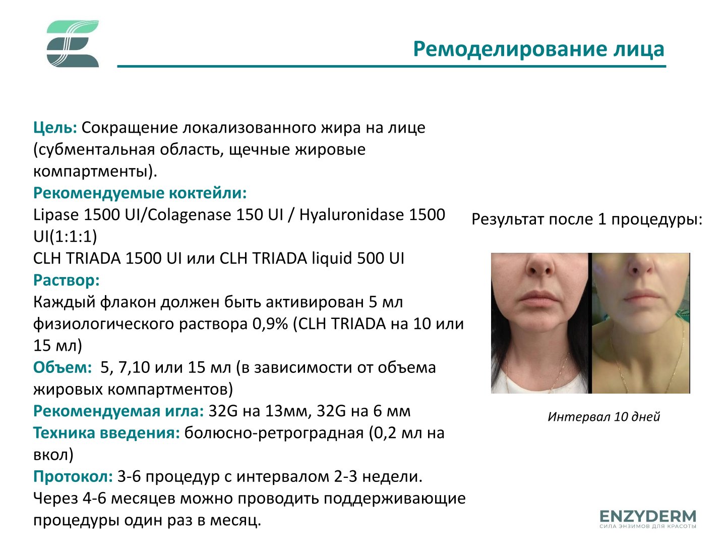 Hyaluronidase 1500 UI Enzyderm