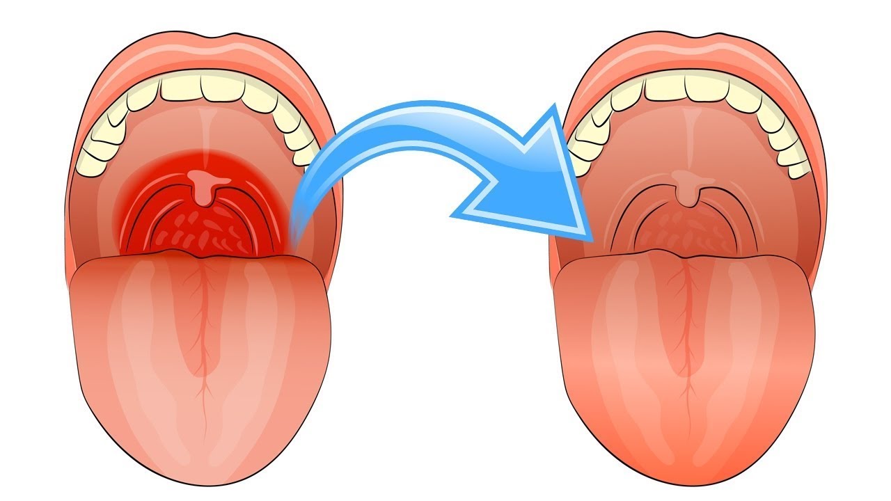 Можно ли повредить горло во время орального секса?