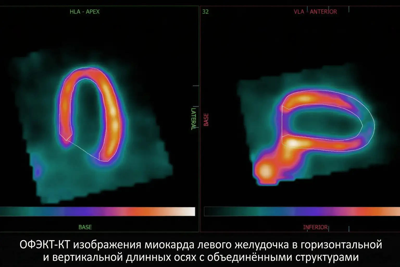 rezultat-scintigrafii