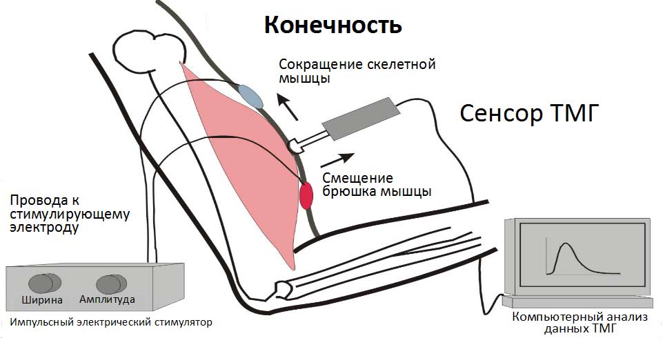 Прибор для записи графического изображения мышечных сокращений