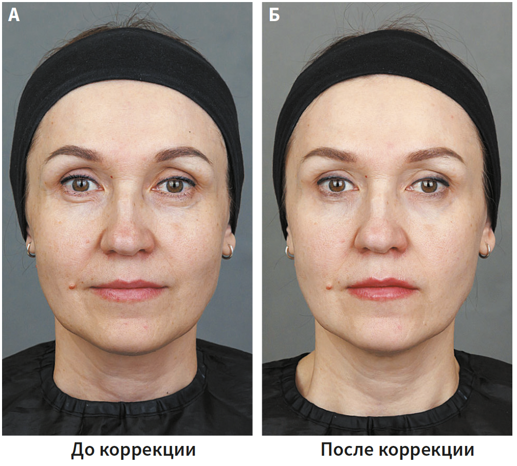 Бычкова (КИТ МЕД) 1-2025_Рис 5.png